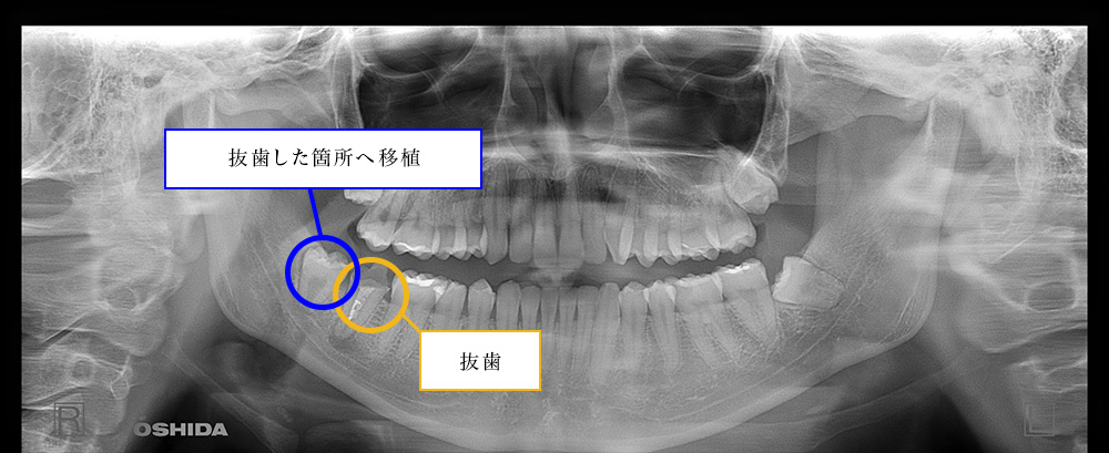 口腔内状況